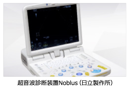 超音波診断装置Noblus（日立製作所）